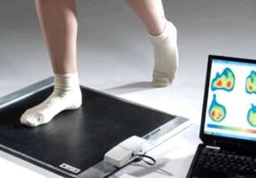 Diagnose eines Hallux valgus