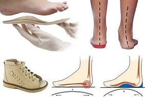 Orthopädische Schuhe für Hallux Valgus bei einem Kind