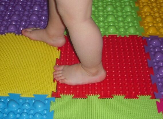 Valgo Pathology Prevention