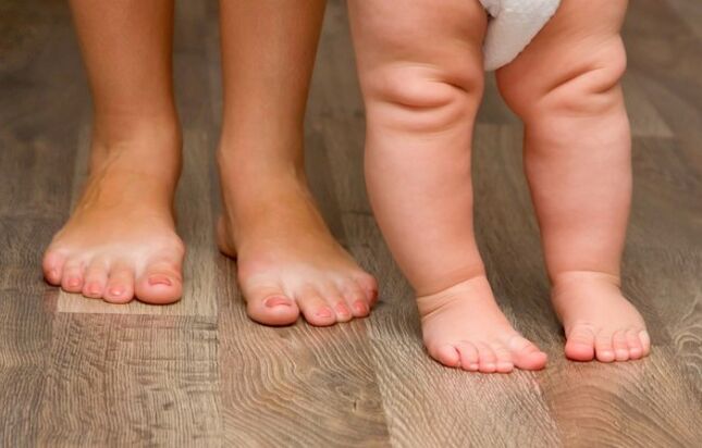 Valgus -Fußdeformation bei Kindern